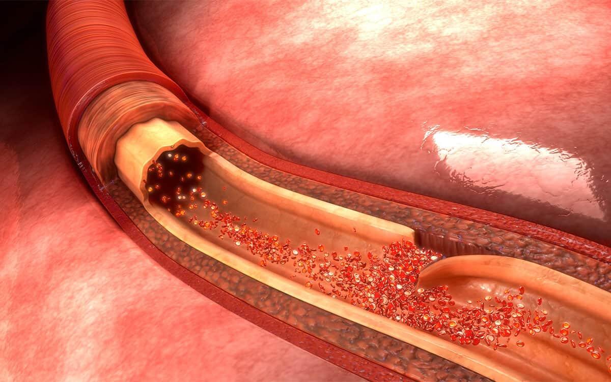 研究イメージ画像