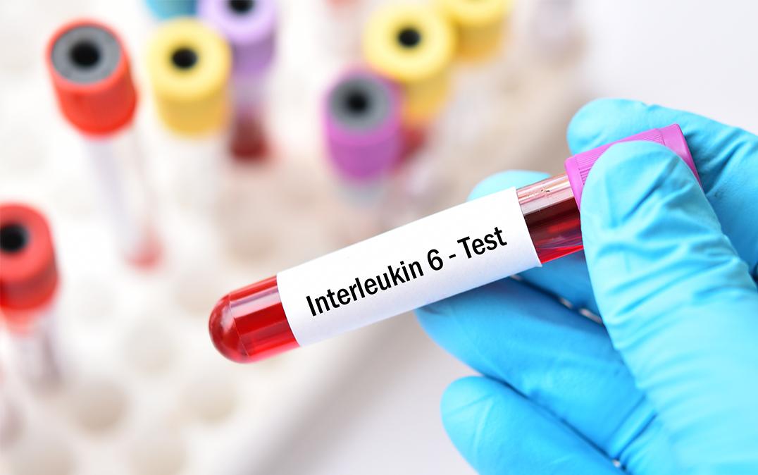インターロイキン(IL)-6